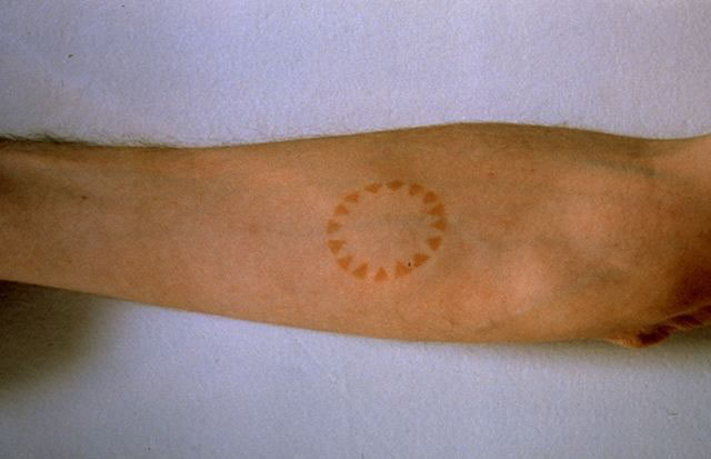 Sole, 1994