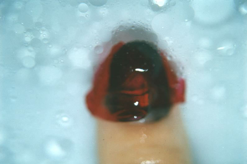 Autoritratto n. 1, 1999
