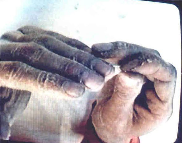 Vinavil, 1995