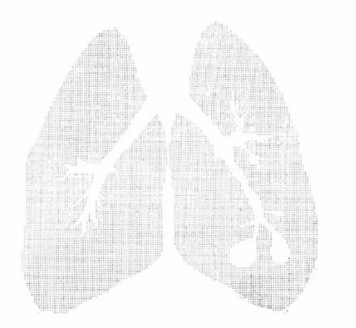 Apparato respiratorio, 1992